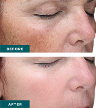 Load image into Gallery viewer, VI Peel